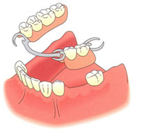 partials