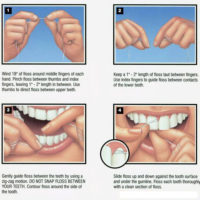 Illustration showing proper way to floss teeth.