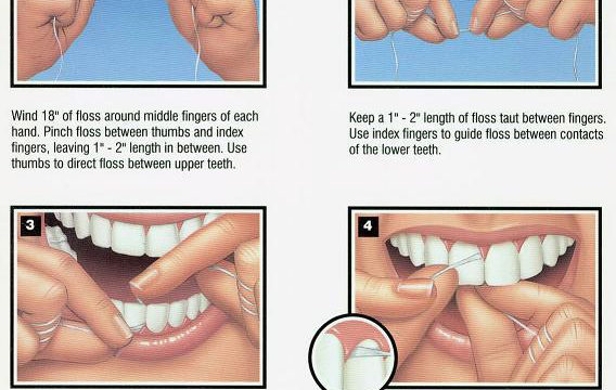 Illustration showing proper way to floss teeth.