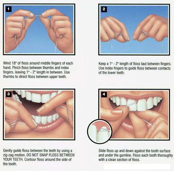 Illustration showing proper way to floss teeth.